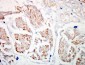 p53 Antibody